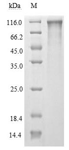 Recombinant Human Novel Coronavirus Spike Glycoprotein (S)